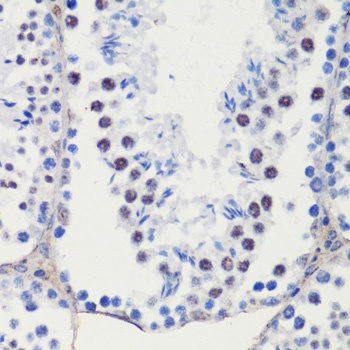 p27 KIP 1 Antibody