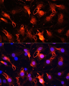 RNF149 Antibody