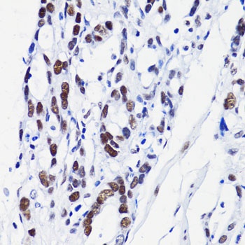 Acetyl-Histone H2B-K15 pAb