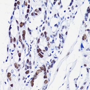 H2B K15ac Antibody