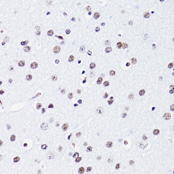 Acetyl-Histone H2B-K15 pAb