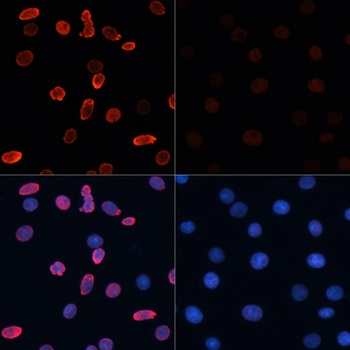 H2B K15ac Antibody