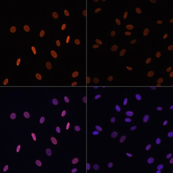 Acetyl-Histone H2B-K15 pAb