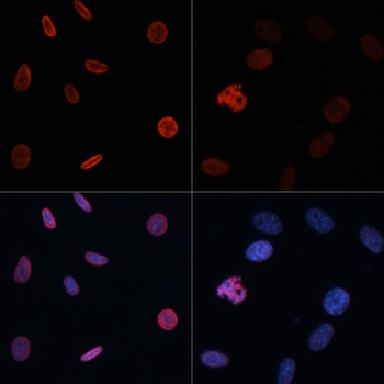 Acetyl-Histone H2B-K15 pAb
