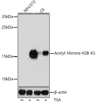 H2B K5ac Antibody