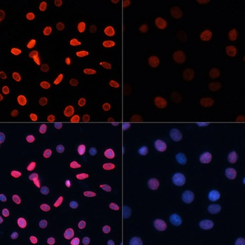H2B K5ac Antibody