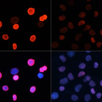 H2B K5ac Antibody