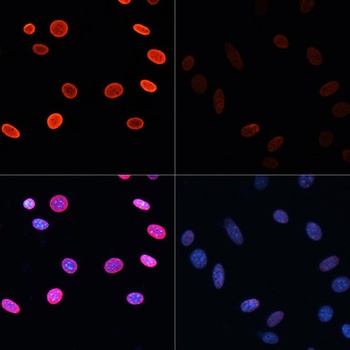 H2B K5ac Antibody