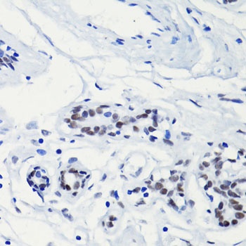H2A K5ac Antibody