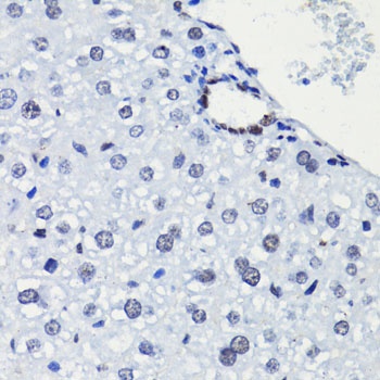 H2A K5ac Antibody