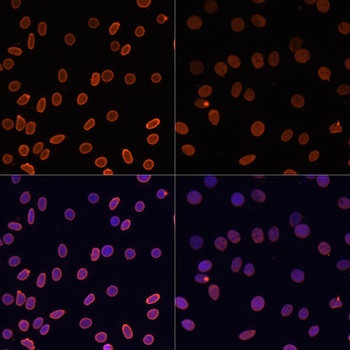 H2A K5ac Antibody