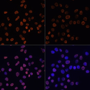 H2A K5ac Antibody