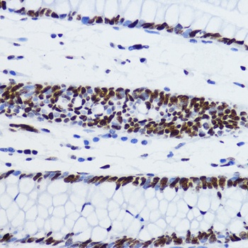 Acetyl-Histone H2B-K12 pAb