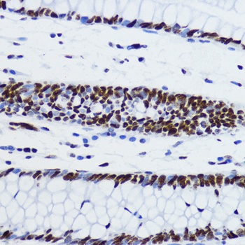 H2B K12ac Antibody