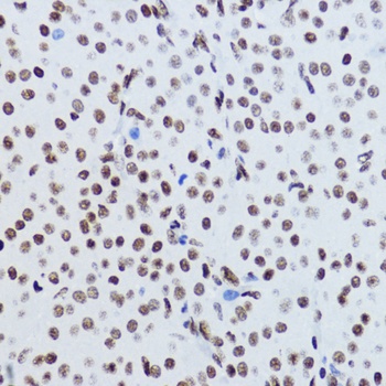 Acetyl-Histone H2B-K12 pAb