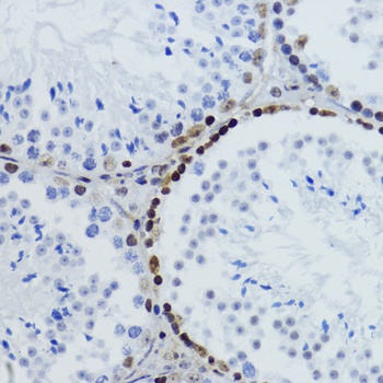 H2B K12ac Antibody