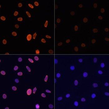 Acetyl-Histone H2B-K12 pAb