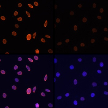 H2B K12ac Antibody