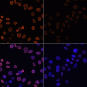 H2B K12ac Antibody