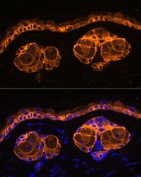 H2B K12ac Antibody