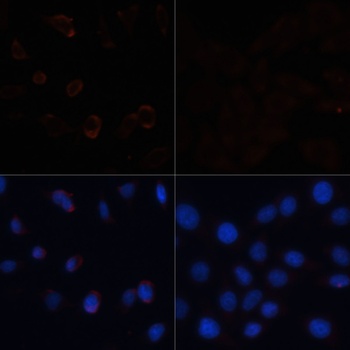 ACACA Antibody