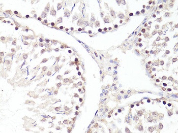 TWIST1 Antibody