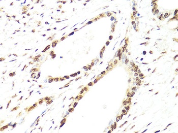 TWIST1 Antibody