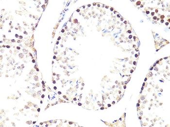 TWIST1 Antibody