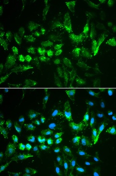 TIMP2 Antibody