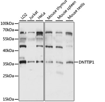DNTTIP1 Antibody
