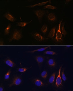 VMP1 Antibody