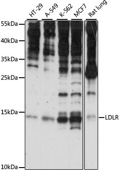 SNRNP25 Antibody