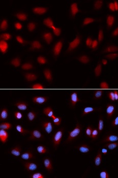 Survivin Antibody