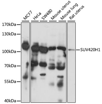 KMT5B Antibody