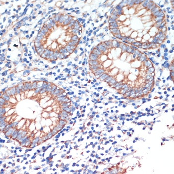 AFG3L2 Antibody