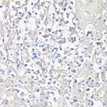 NFAT2 Antibody