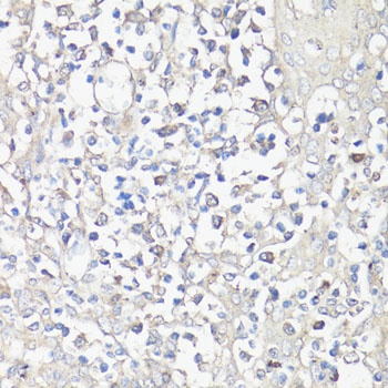 NFATC1 Antibody