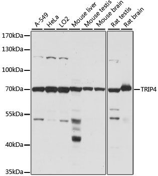 TRIP4 Antibody