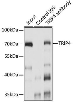 TRIP4 Antibody