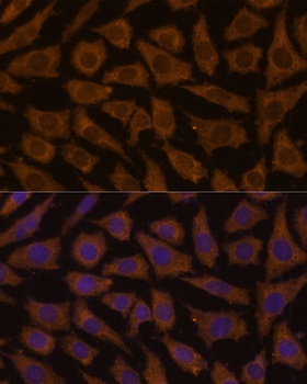 MTMR4 Antibody