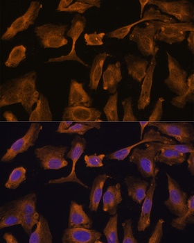 MTMR4 Antibody