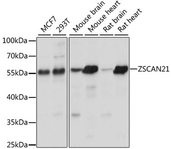 ZSCAN21 Antibody