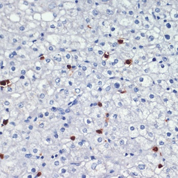 S100A8 Antibody