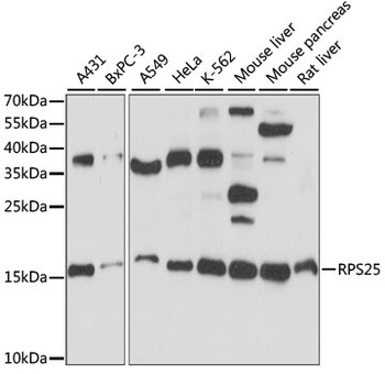 RPS25 Antibody