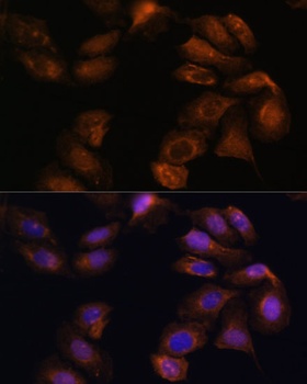 ROBO1 Antibody