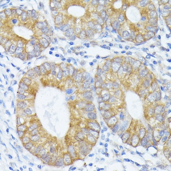 PFDN4 Antibody