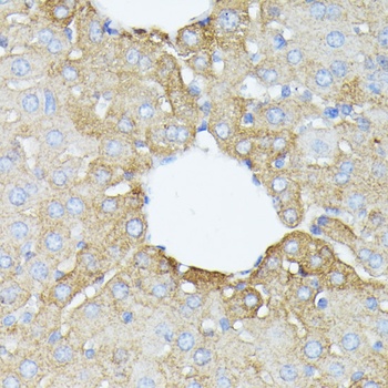 PFDN4 Antibody