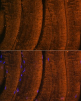 MYH2 Antibody