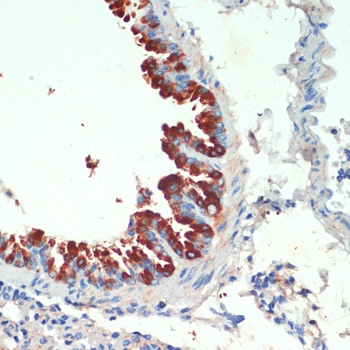 KIF5B Antibody