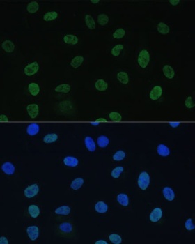 GTF2E1 Antibody